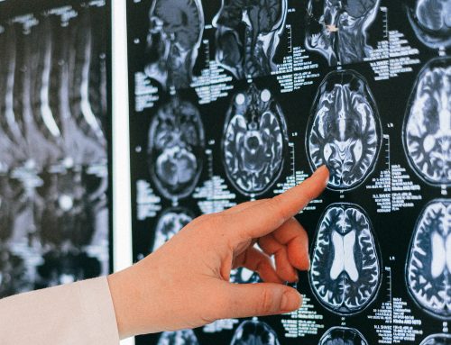 Las proteínas p27 y MEX3a, dos reguladores clave en la producción de nuevas células neurales en adultos